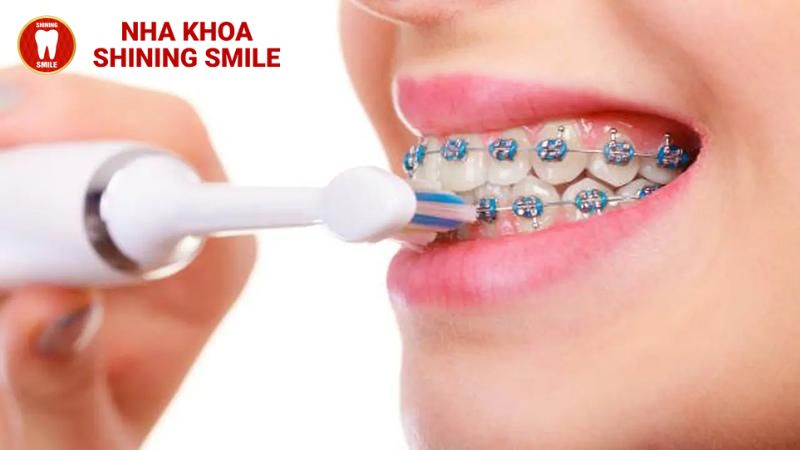 Thực Đơn Hoàn Hảo Cho Người Niềng Răng