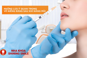 Niềng Răng và Nâng Mũi: Liệu Có Thể Kết Hợp?