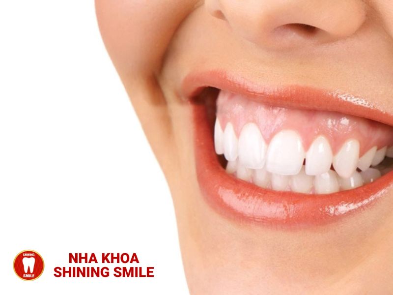 Niềng Răng Có Nên Súc Nước Muối: Những Điều Bạn Cần Biết