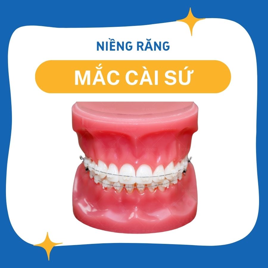 NIENG-RANG-1.jpg