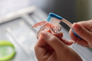Bí Quyết Vệ Sinh Hàm Duy Trì Khỏe Mạnh Sau Niềng Răng