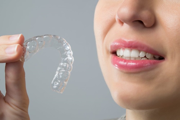 Niềng răng trong suốt Clear Aligner là gì? Hiệu quả điều trị có tốt không? 4 Niềng răng trong suốt Clear Aligner là gì? Hiệu quả điều trị có tốt không? 4
