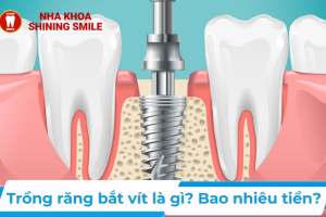 thiet-ke-chua-co-ten-25-2.png