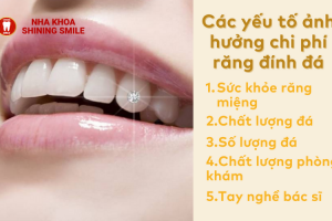 Dán Sứ 2 Răng Cửa Bao Nhiêu Tiền? Khám Phá Chi Phí Hấp Dẫn