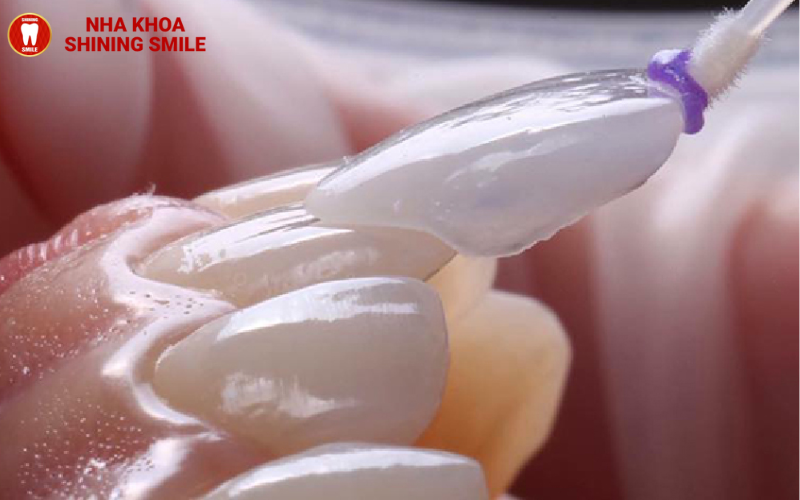 Răng Sứ Zirconia Giá Bao Nhiêu? Chi Phí Cập Nhật Mới Nhất