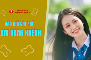 Làm Răng Khểnh Giá Bao Nhiêu Tiền? Tìm Hiểu Ngay Để Biết Chi Tiết